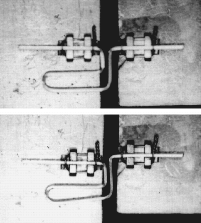 FIGURE 2. The load deflection rate of an L-loop is being tested: top, passive state; bottom, loop in activation