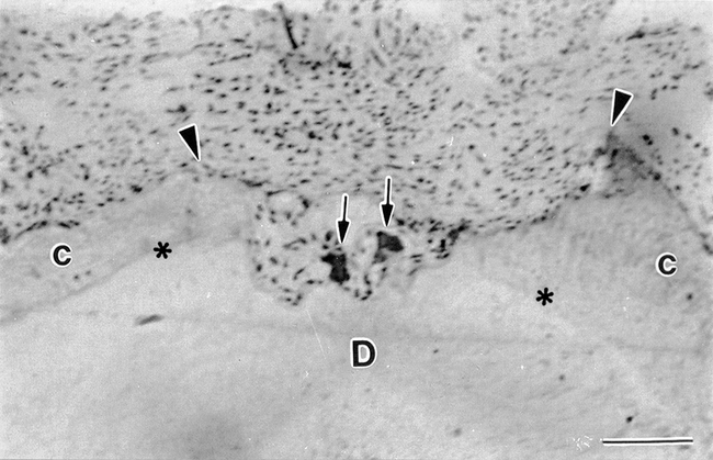 Figure 4. Continuous torque moment for 4 weeks. Two TRAP-positive clastic cells (arrows) appear inside a resorbing lacuna (between arrowheads) that has reached the root dentin (D) at the pressure side. C, cementum; asterisks, dentinocementum junction. Bar = 10 μm